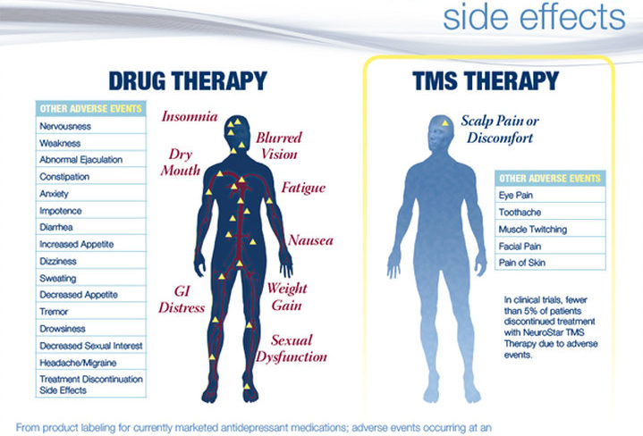 Comparing the side effects of antidepressants to the side effects of TMS