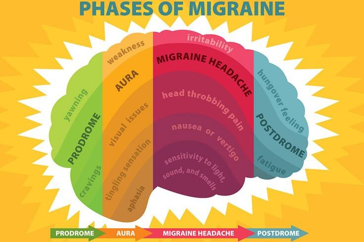 phases of a migraine