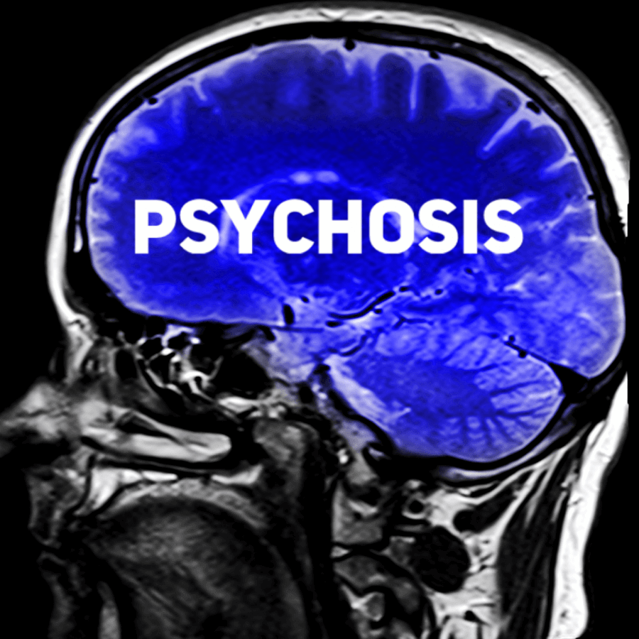 psychosis brain