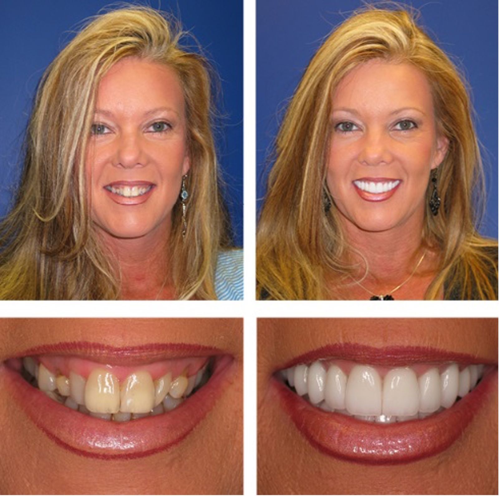 Cosmetic Dentist Vero Beach Florida Vero Dental Spa