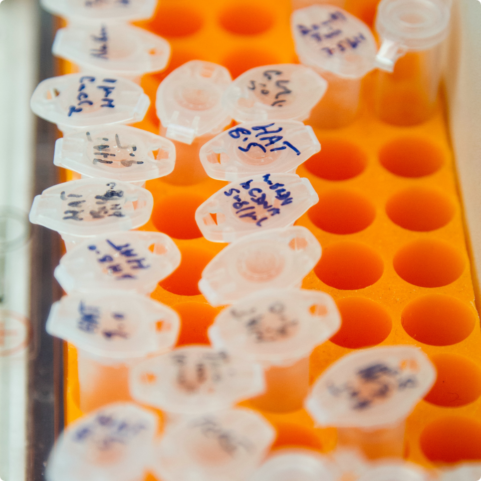 group of medical vials in an orange tray