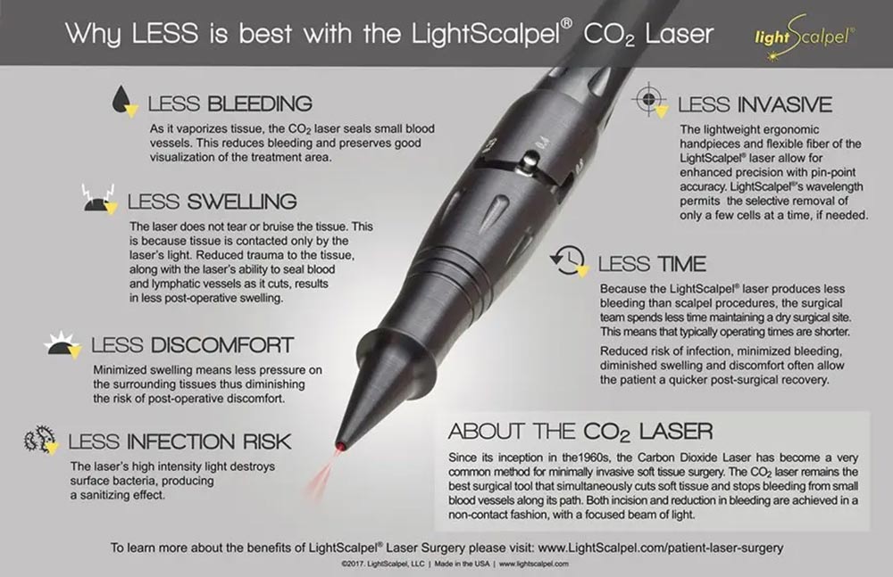 LightScalpel CO2 Laser - Frenectomy in Narberth, PA