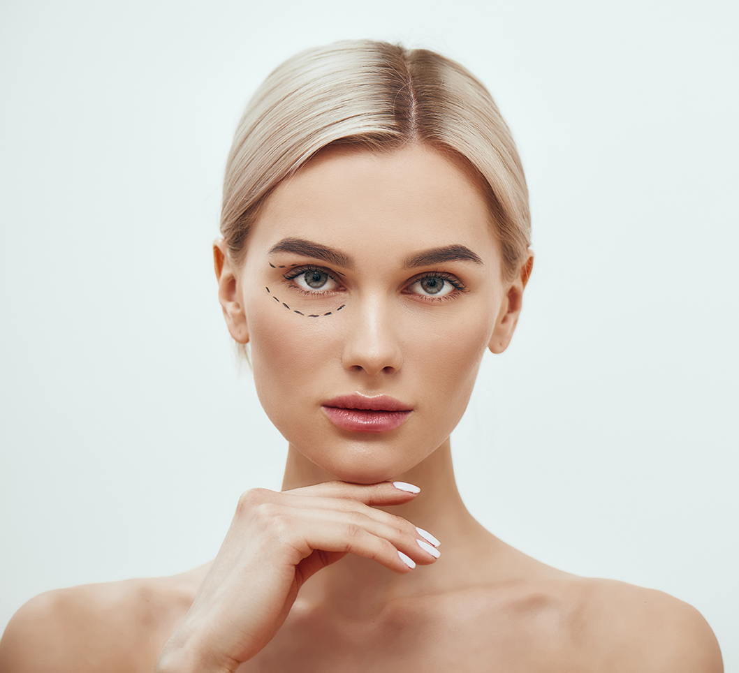 blefaroplastia aria medical