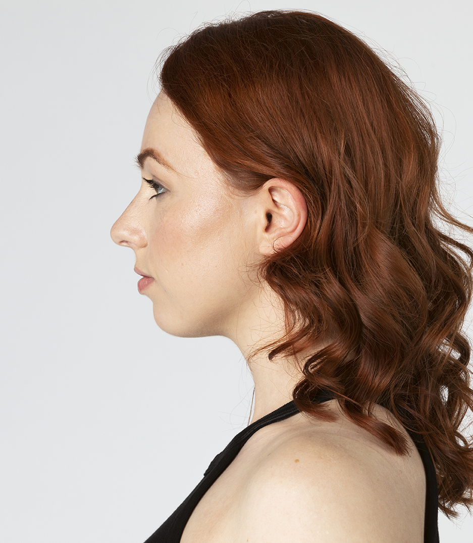 rinoplastia aria medical