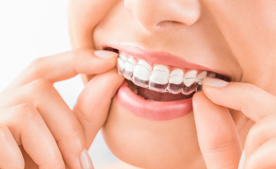 Beautiful smile and white teeth of a young woman