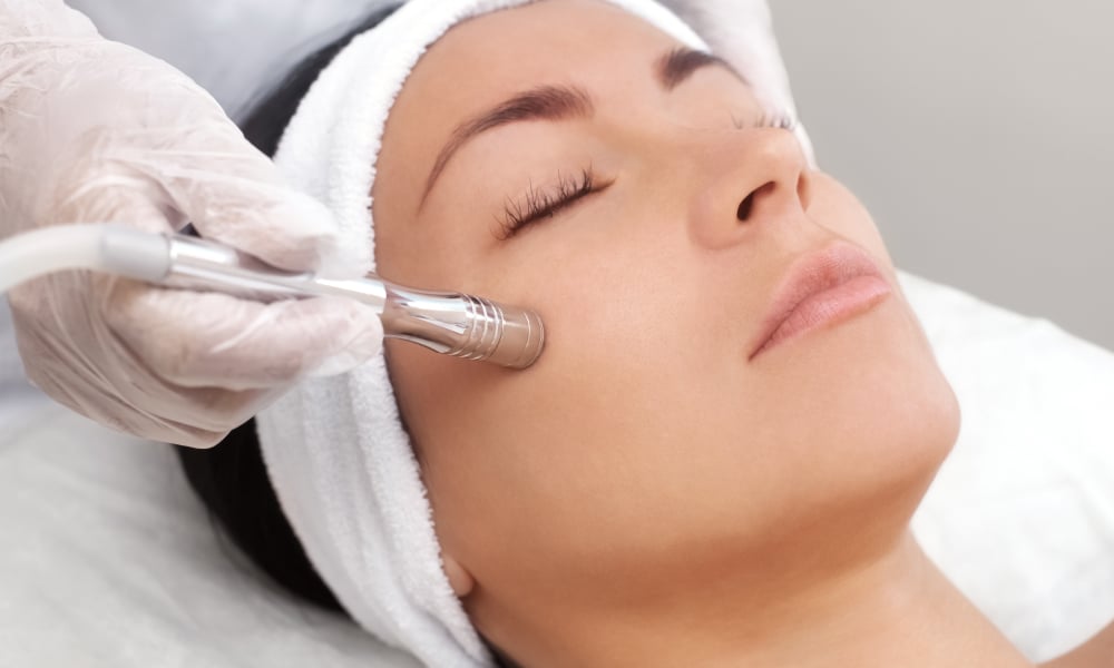 Peeling medyczny – wskazania, efekty, przebieg