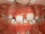 phase-one treatment