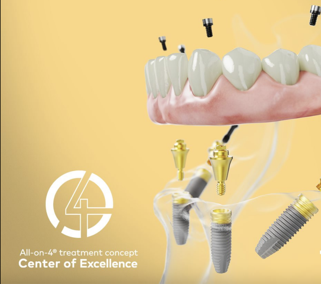 7 Things to Consider When Choosing Your Allon4 Clinic