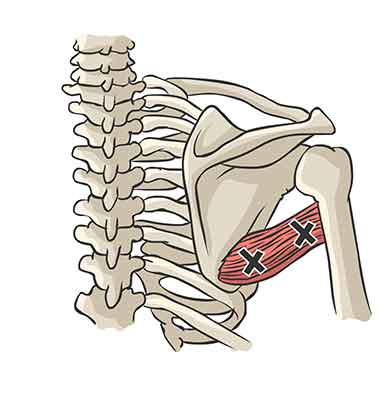 Trigger Point Grand Rond RBM Exclusive | Teres Major of Grote ronde armspier