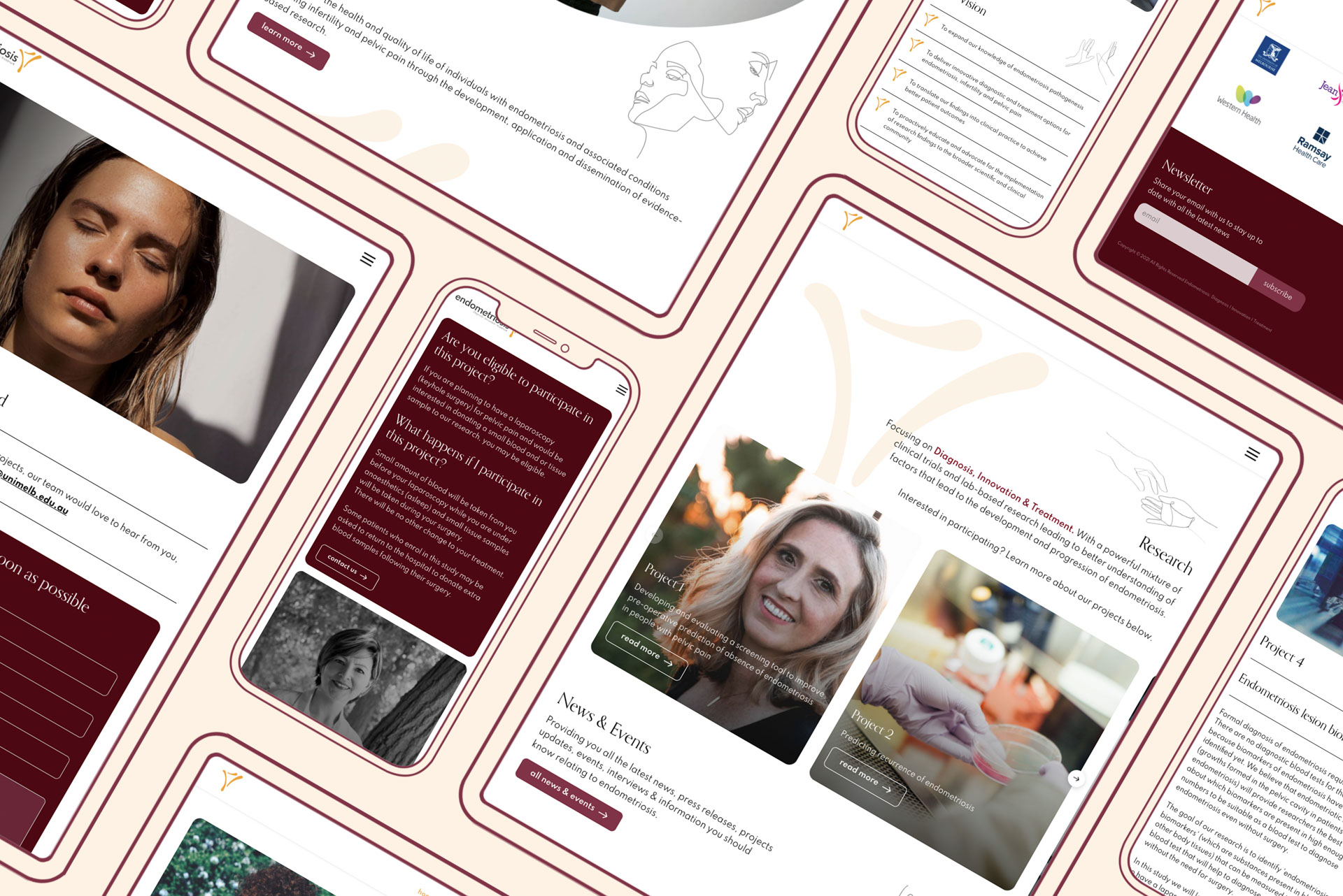 Researching the Diagnosis, Innovation and Treatment of Endometriosis