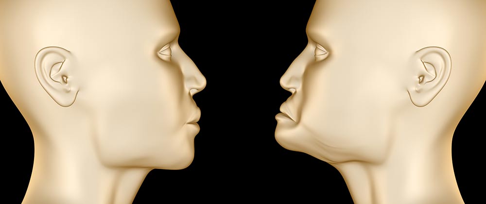 Illustrative image showing jaw bone density