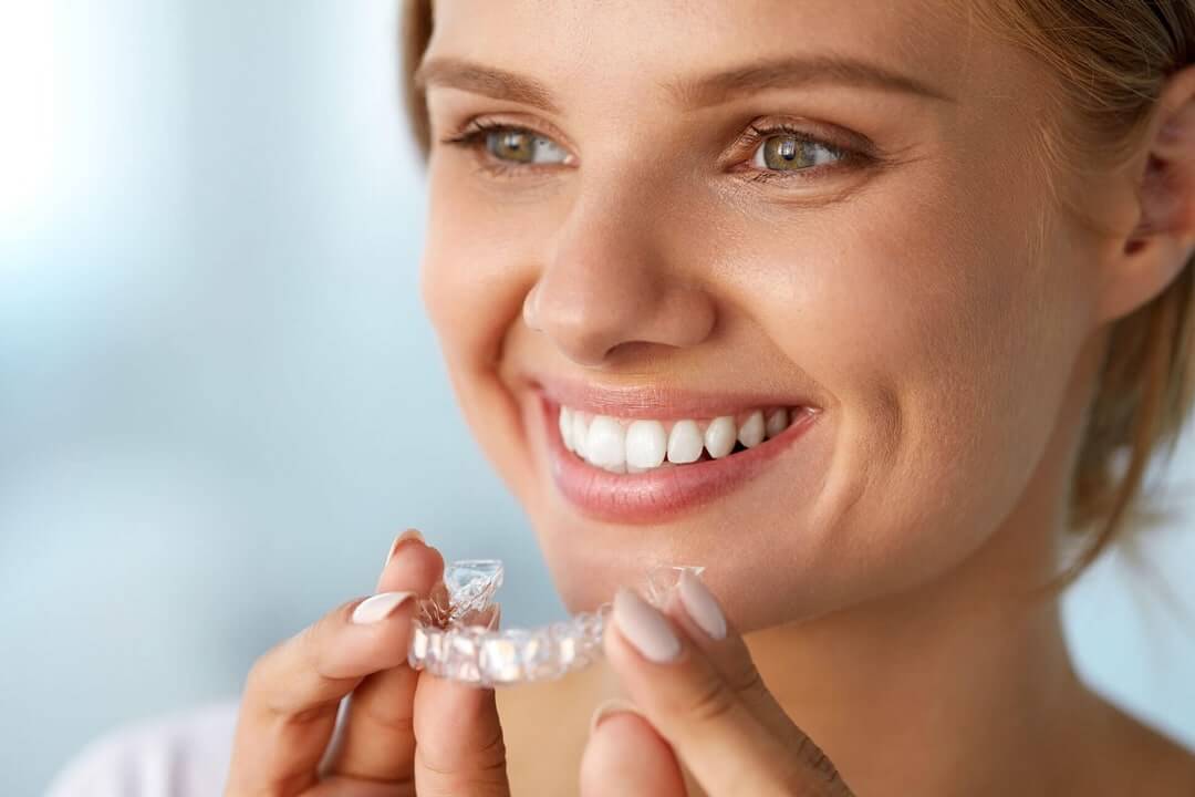 Clear aligners