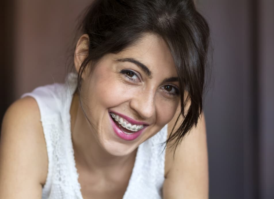 A picture of a girl with braces.