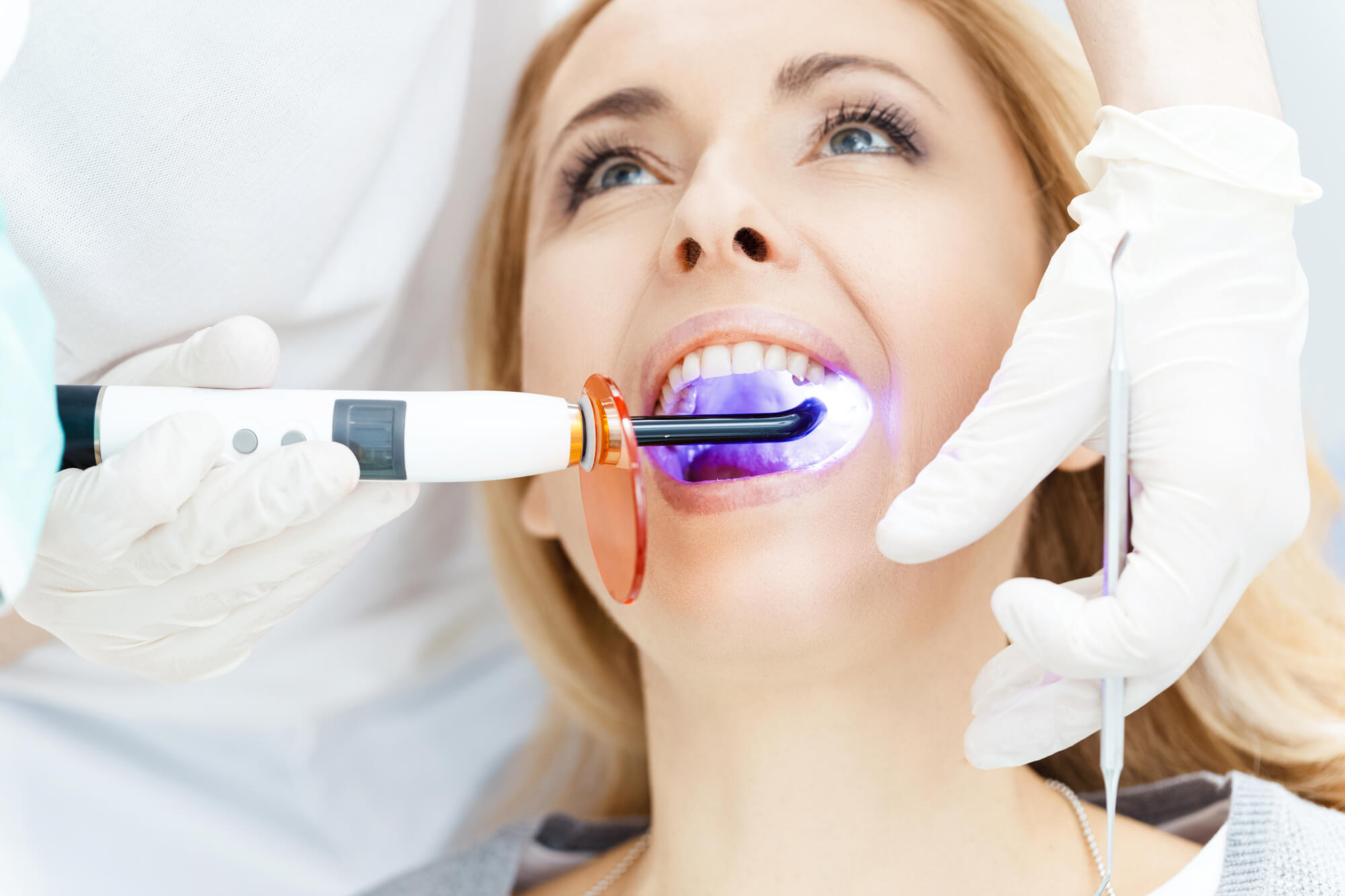 What You Wish You'd Known Before Choosing DIY Teeth Whitening