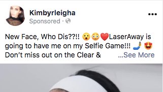influencer-whitelisting-ad-copy-example-laseraway