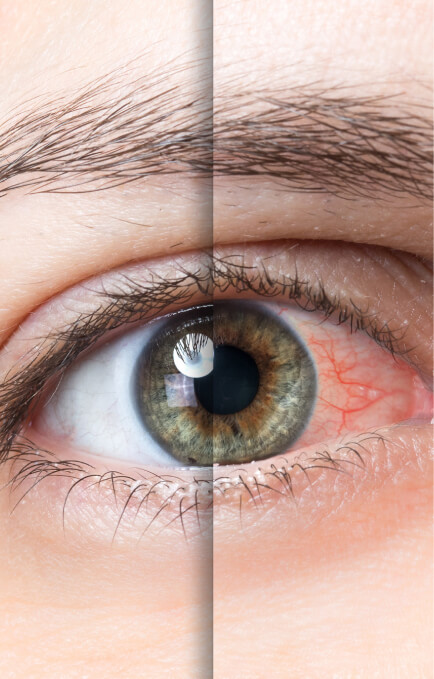 Image of a zoomed in eyeball