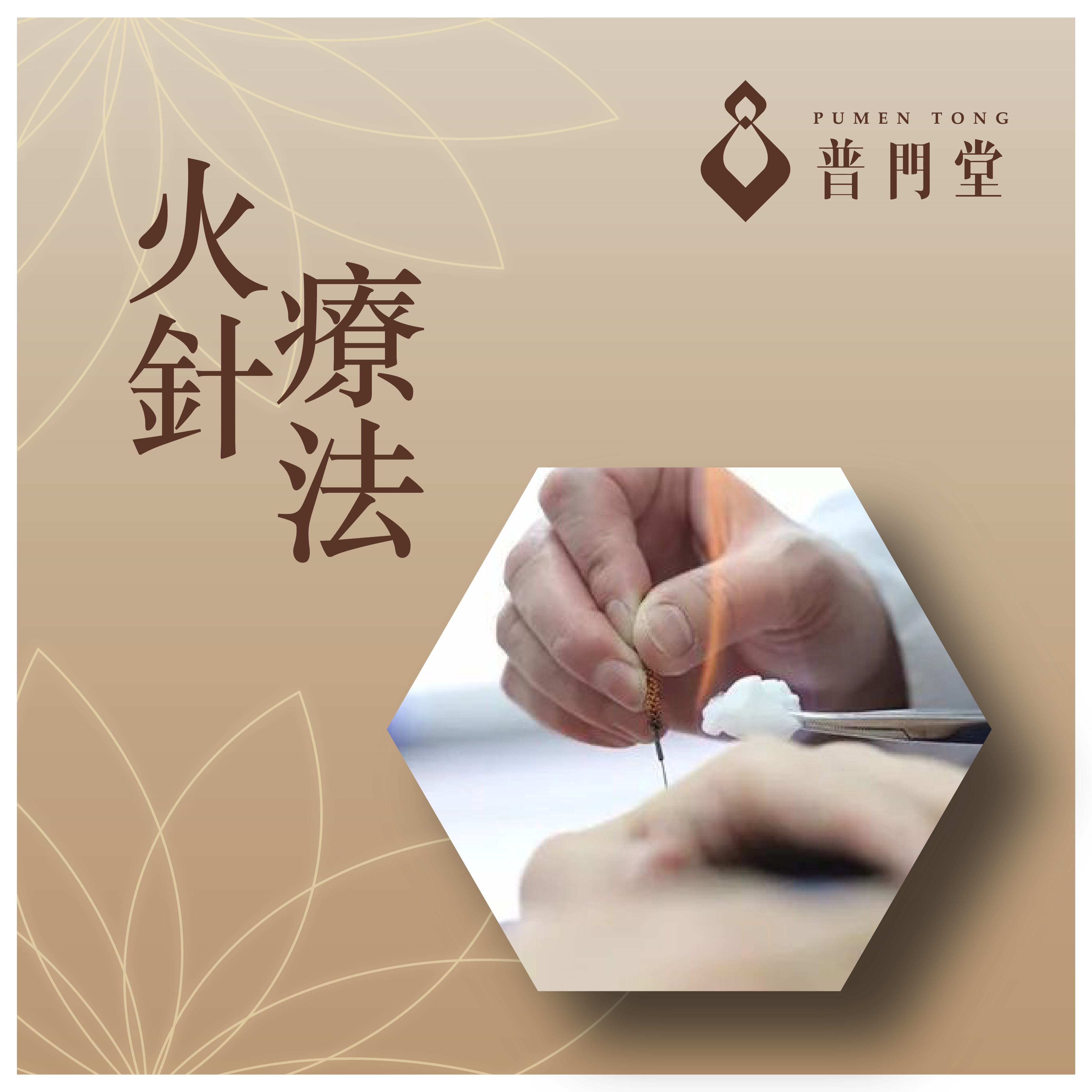 火針