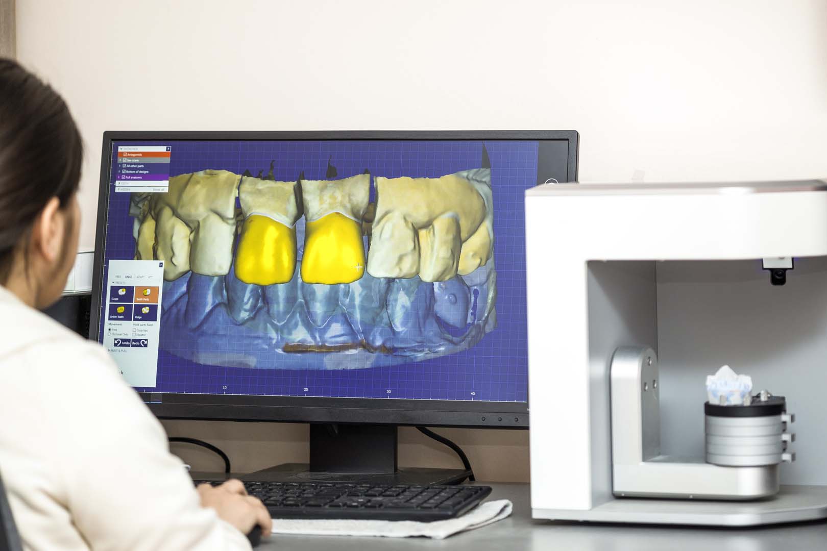 What is Digital Scanning?