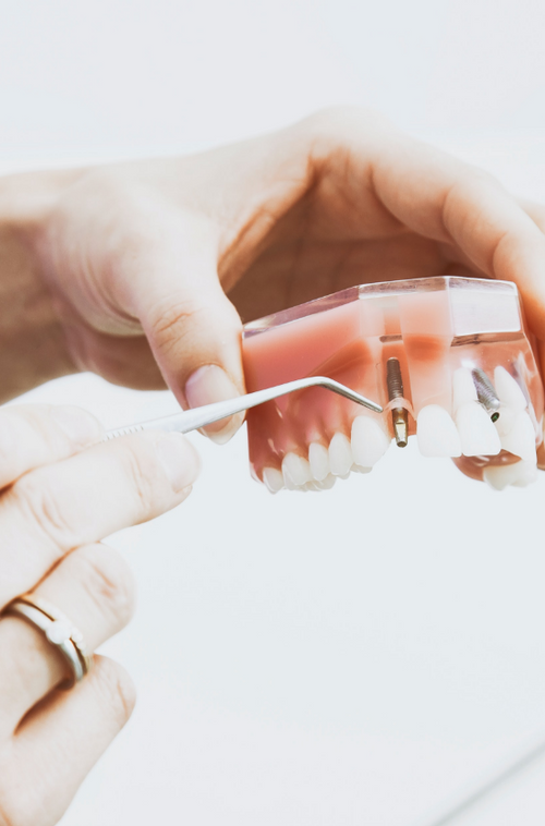 Dentist in Ocoee, FL Colonial Drive Family Dentistry