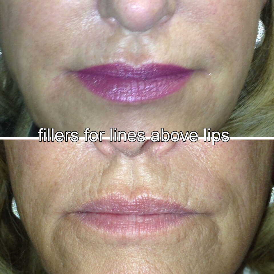 Before & After Gallery