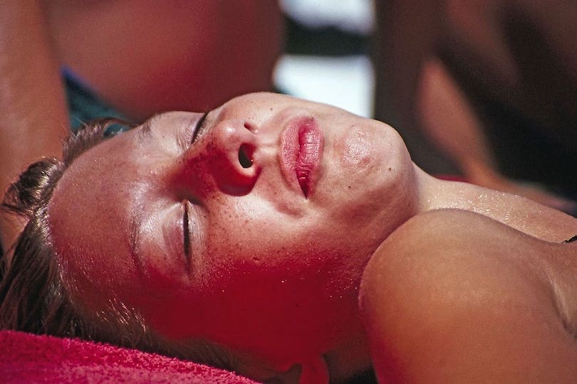 Was hilft gegen Sonnenbrand?