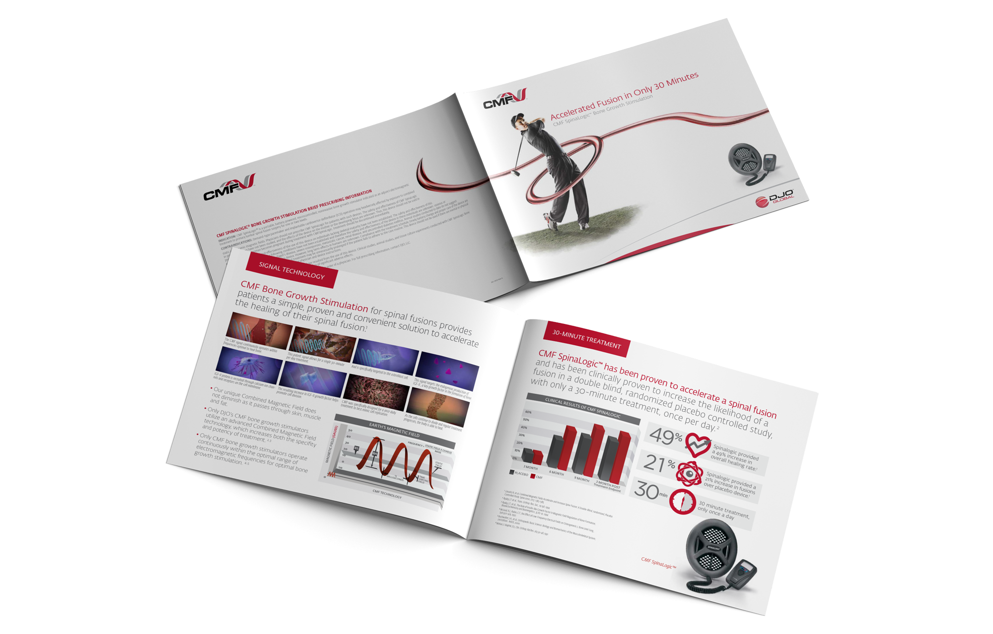 djo case study physician kit 2