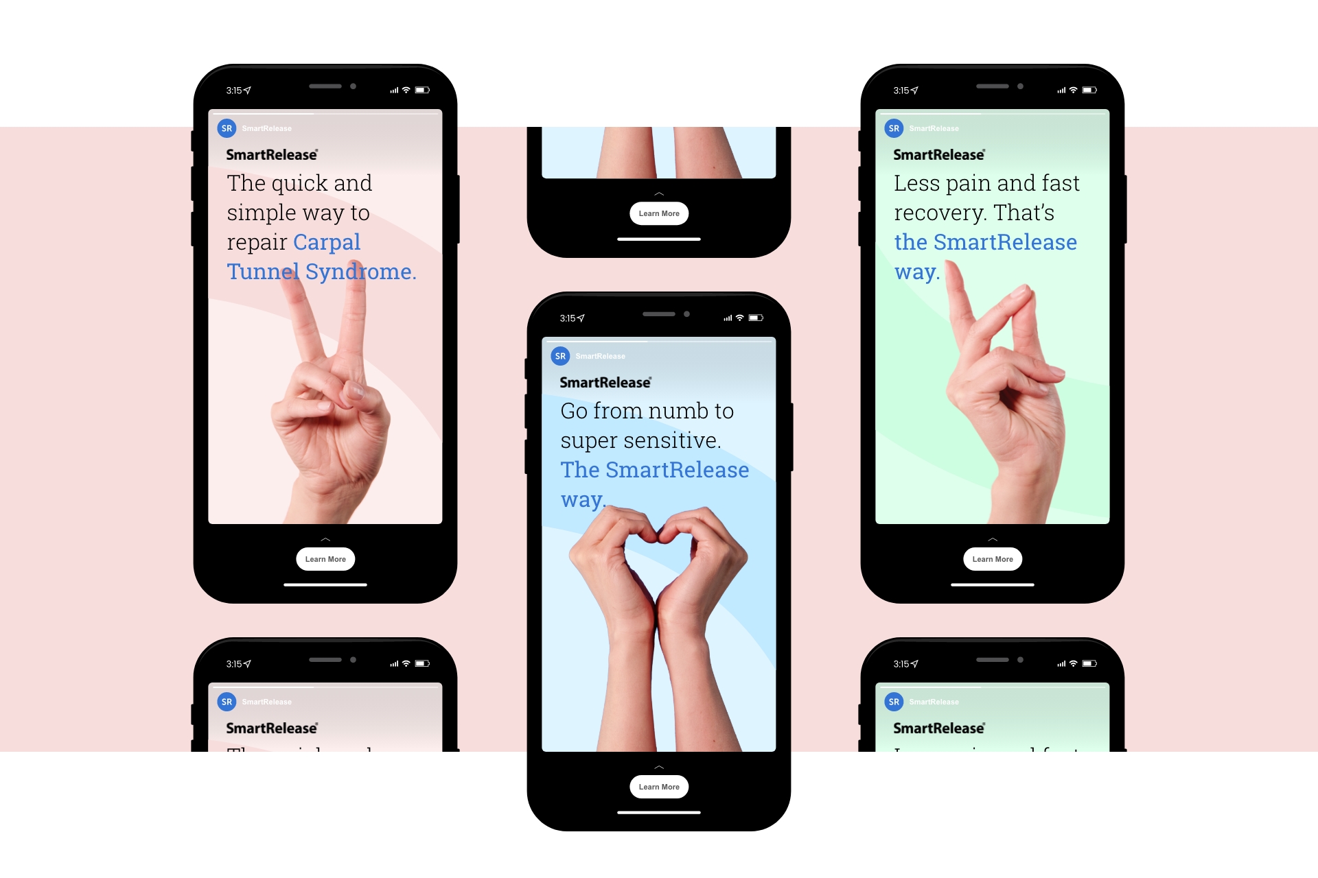 microaire smartrelease case study social stories