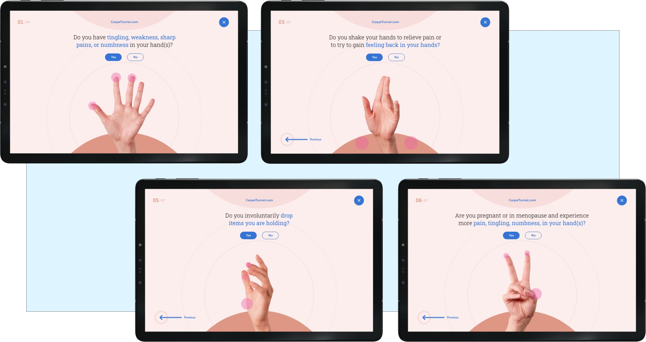 microaire smartrelease case study quiz