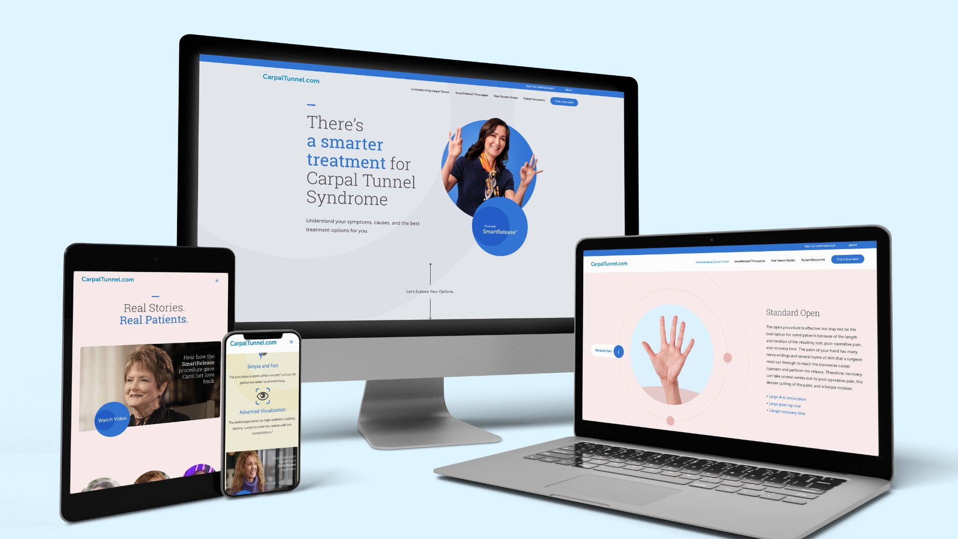 microaire smartrelease case study responsive website