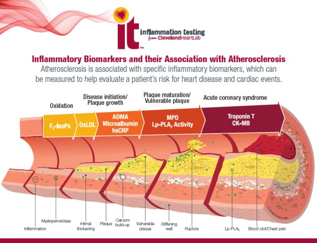 atherosclerosis and ED