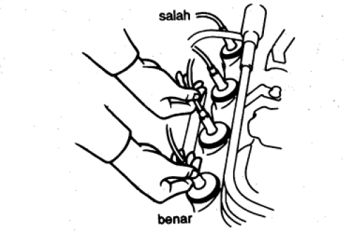 Gambar cara melepaskan kabel busi yang benar