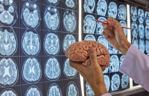 Neurosurgeon Indonesia