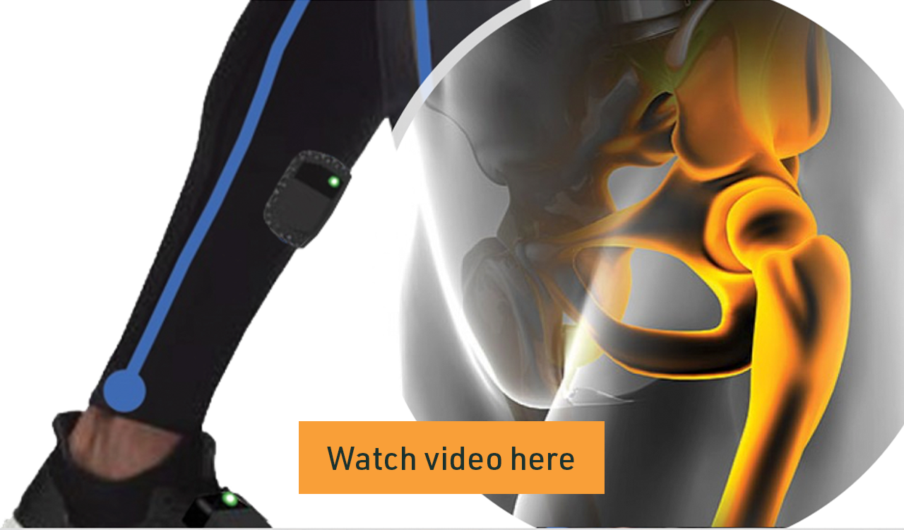 A SMART move to stop hip pain