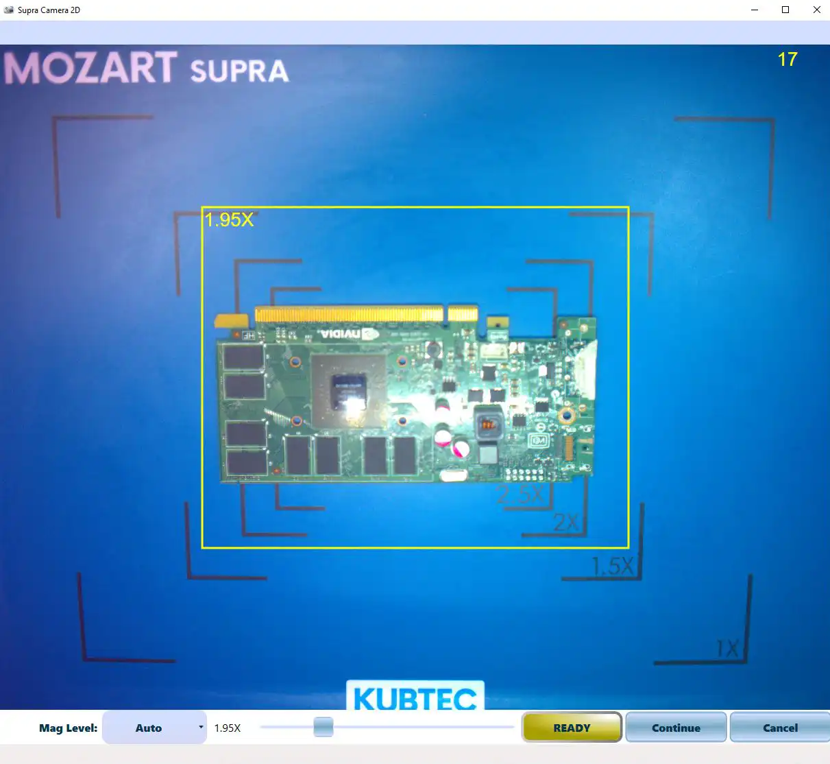 PARAMETER® Supra Tomosynthesis System