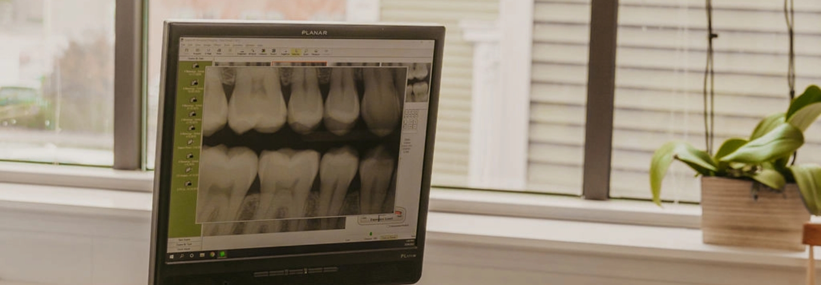 About Us Brightwork Dental Care