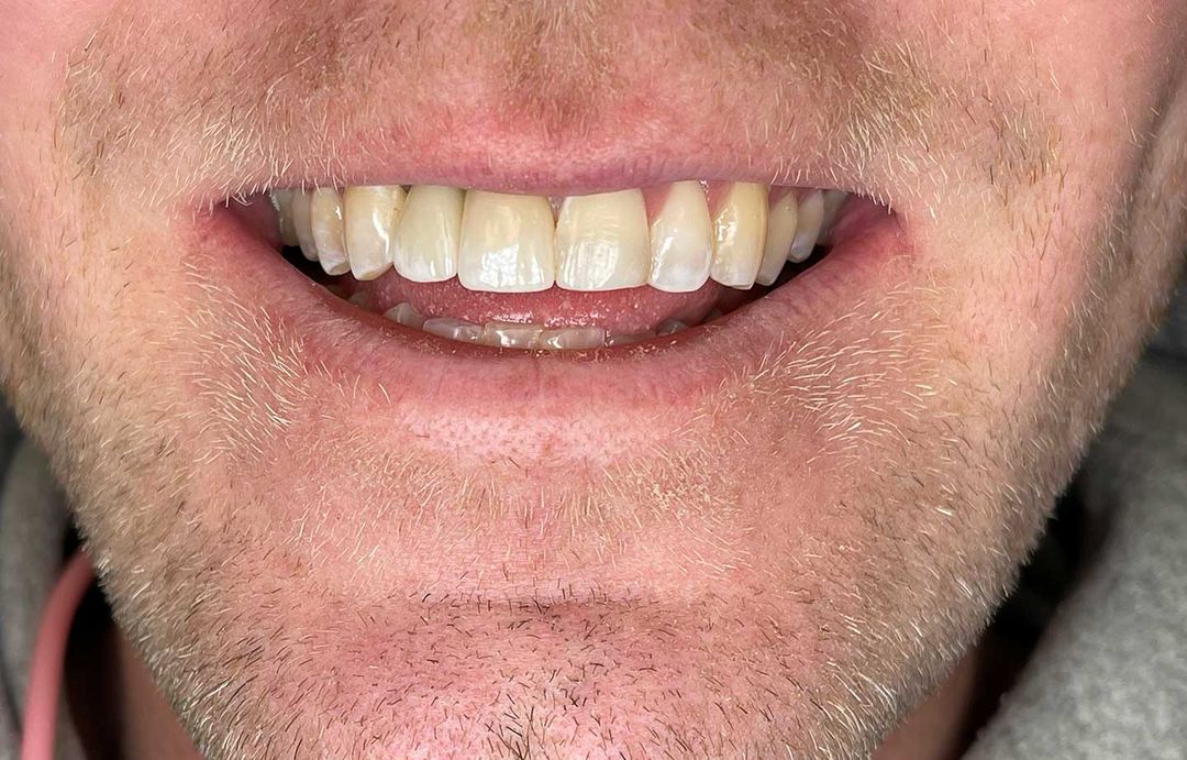 Dentist in Bath Brightwork Dental Care