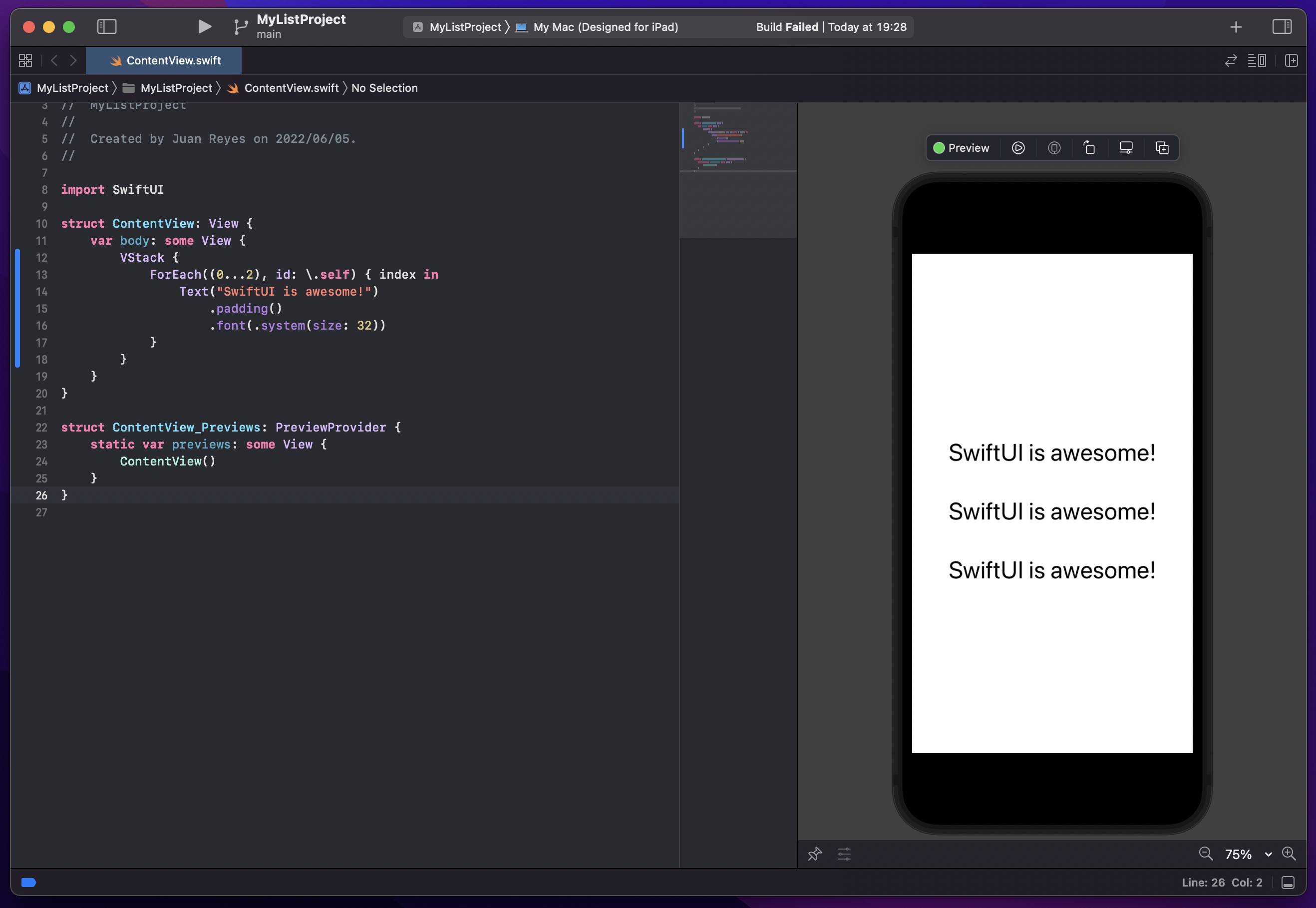 Screenshot of contentview.swift.