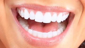 Close Up of Smile | Cosmetic Dentistry Huntsville AL
