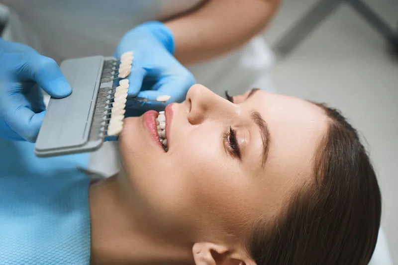 A patient choosing which shade of white she prefers for her teeth.