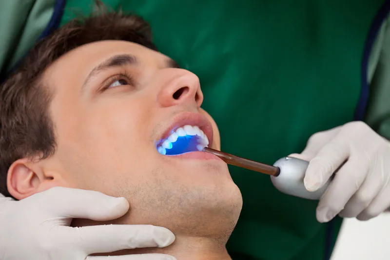 A man getting his teeth whitened by a cosmetic dentist.