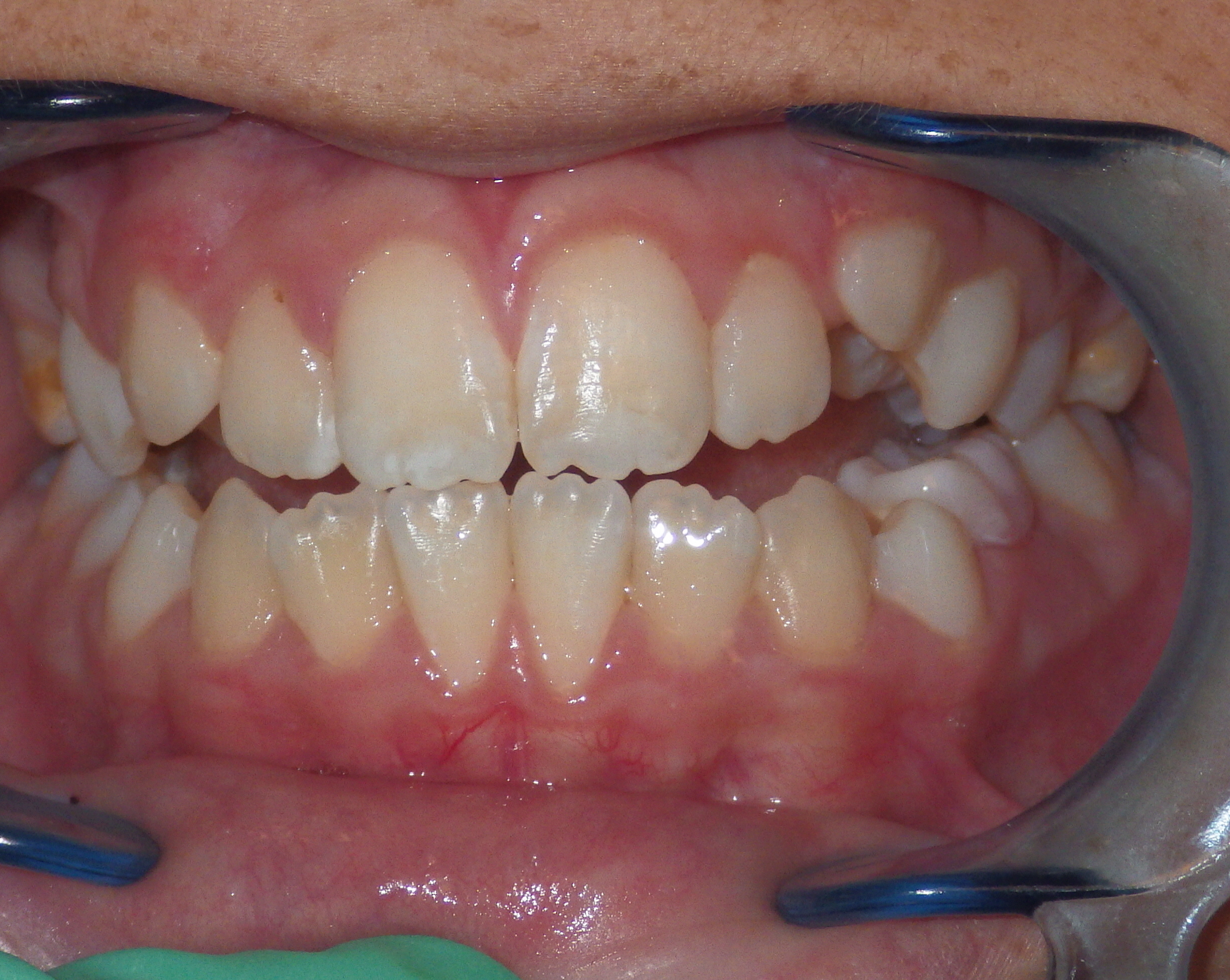 before and after treatment