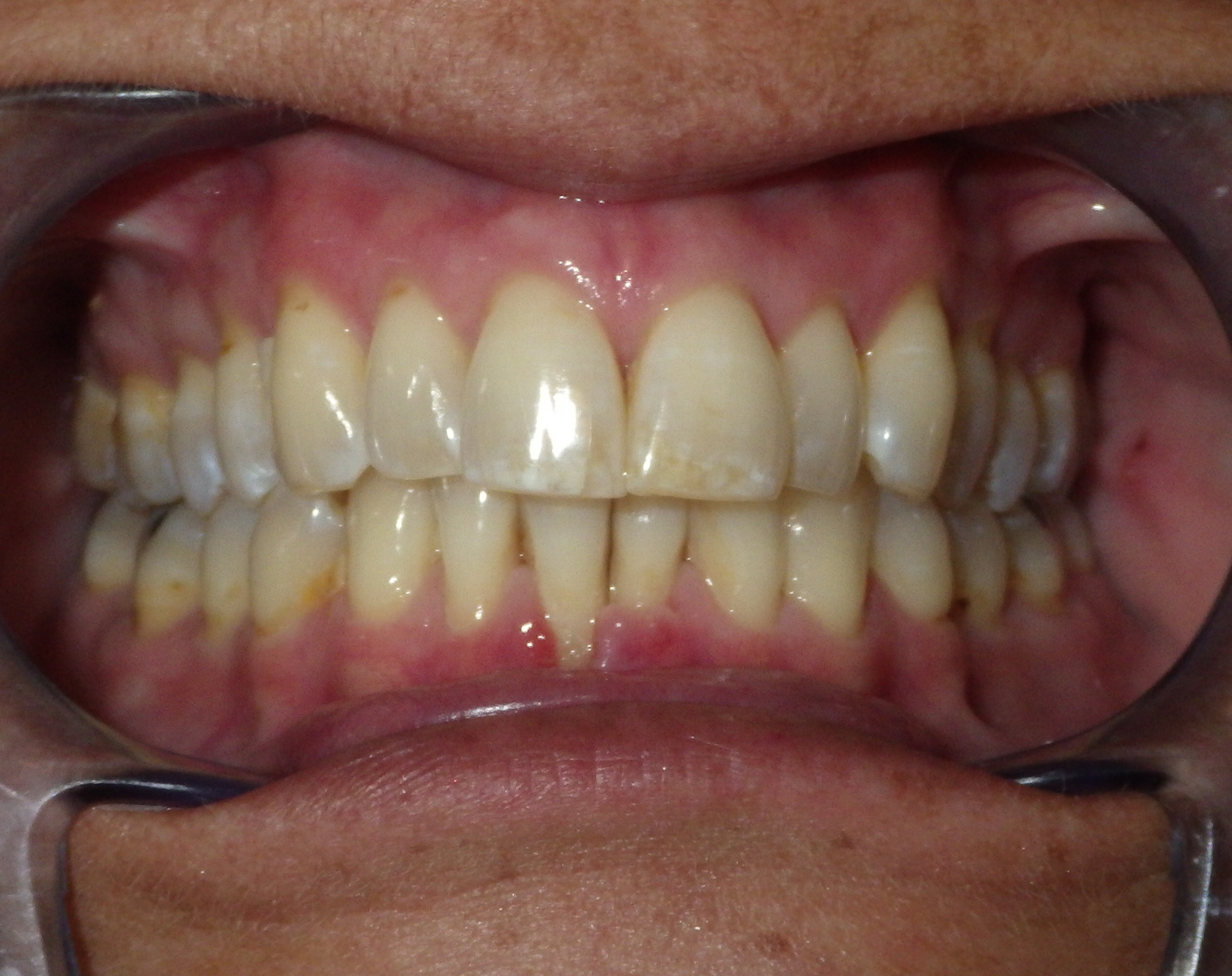 before and after treatment