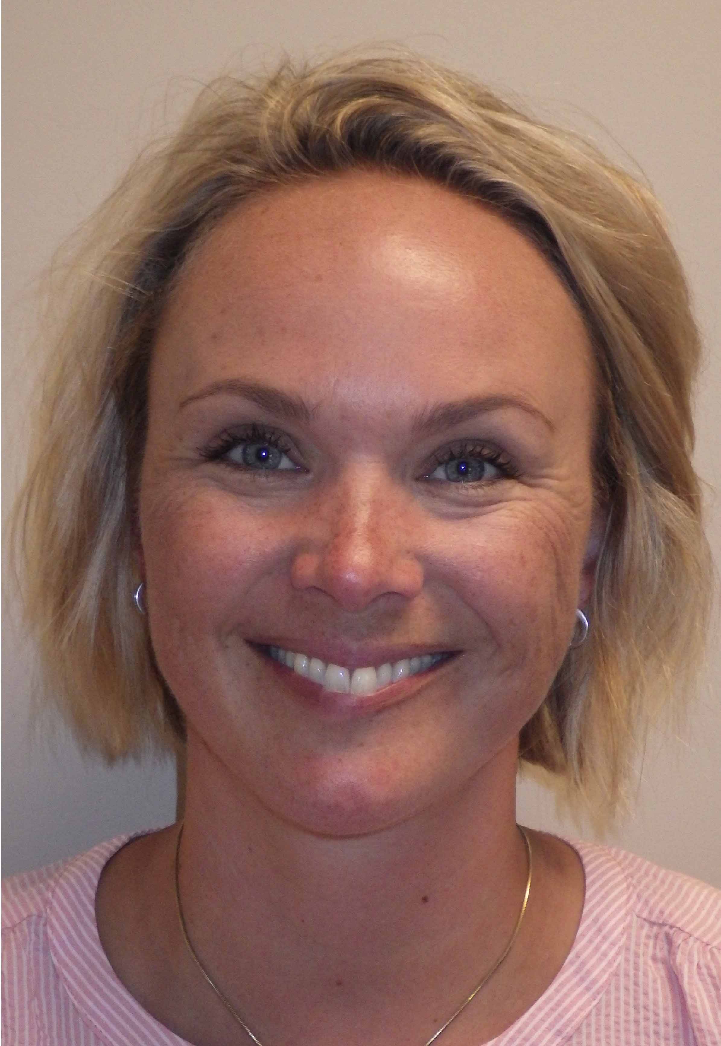 before and after treatment