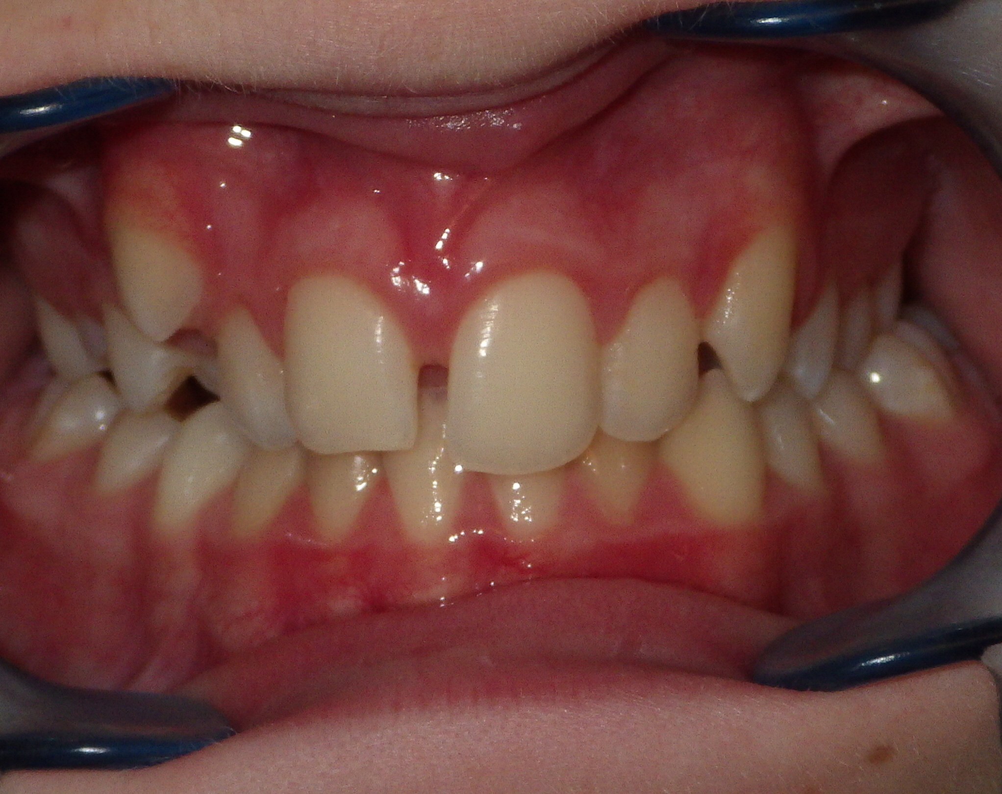 before and after treatment