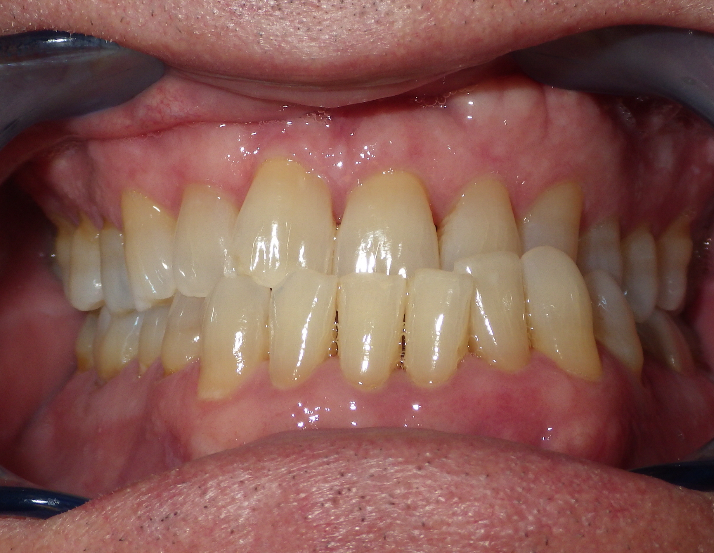 before and after treatment