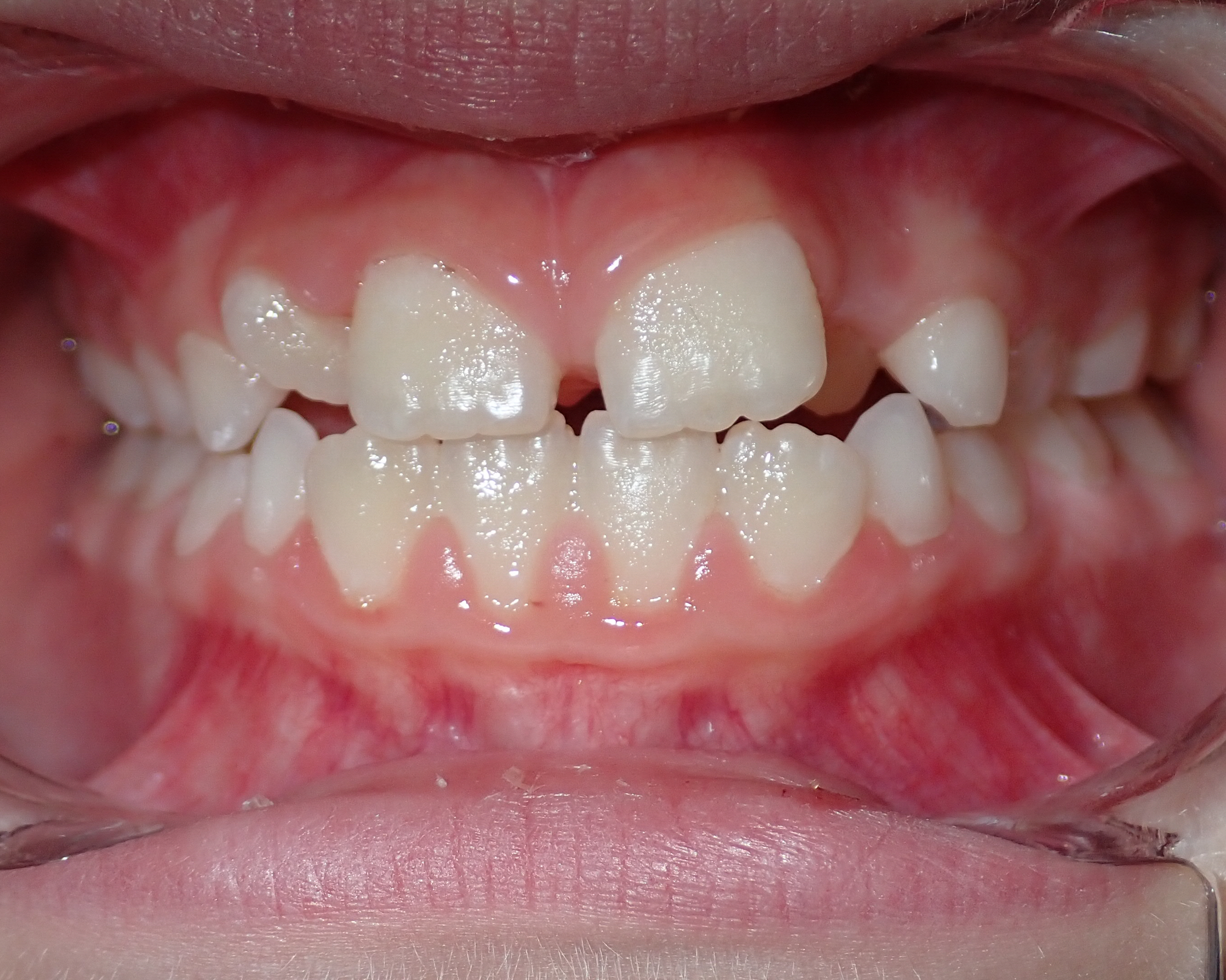 before and after treatment