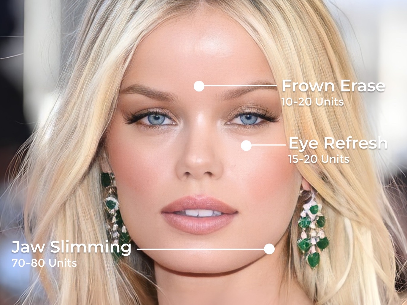 upkeep-how-soon-can-i-touch-up-botox-and-fillers