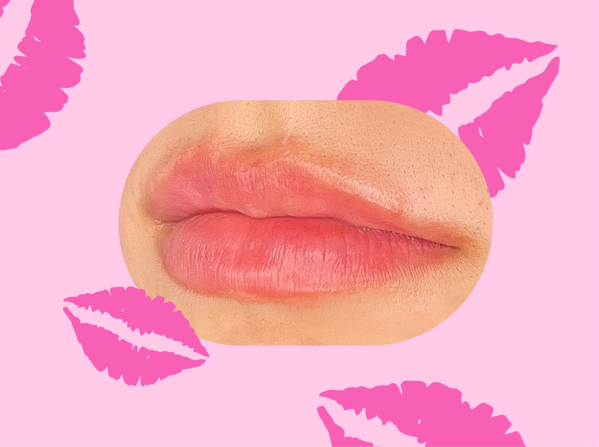 Upkeep The First Real Lip Filler App Is Here