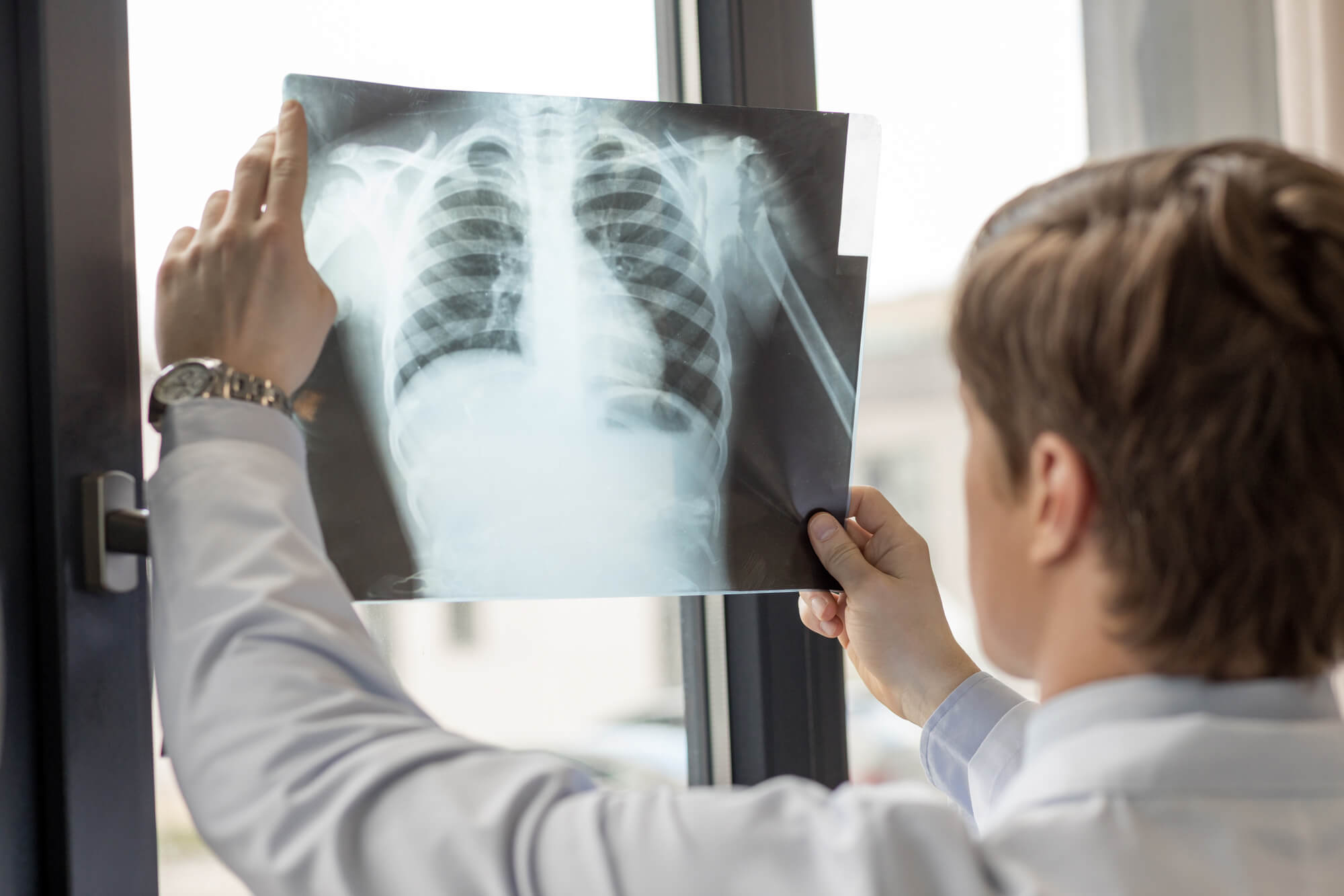 How Urgent Care Chest X-Rays Can Help Diagnose Common Respiratory Issues