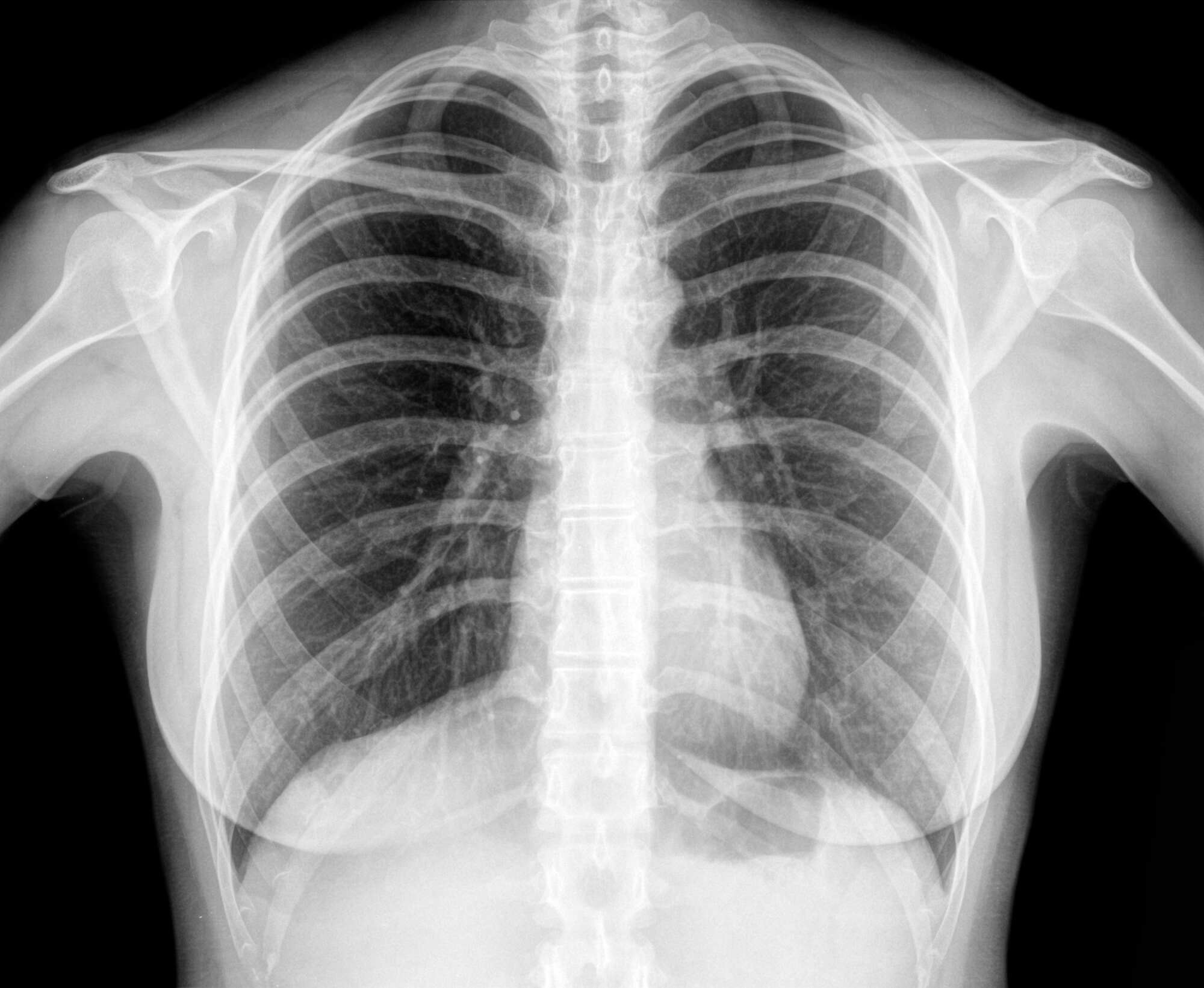 How Urgent Care Chest XRays Can Help Diagnose Common Respiratory Issues